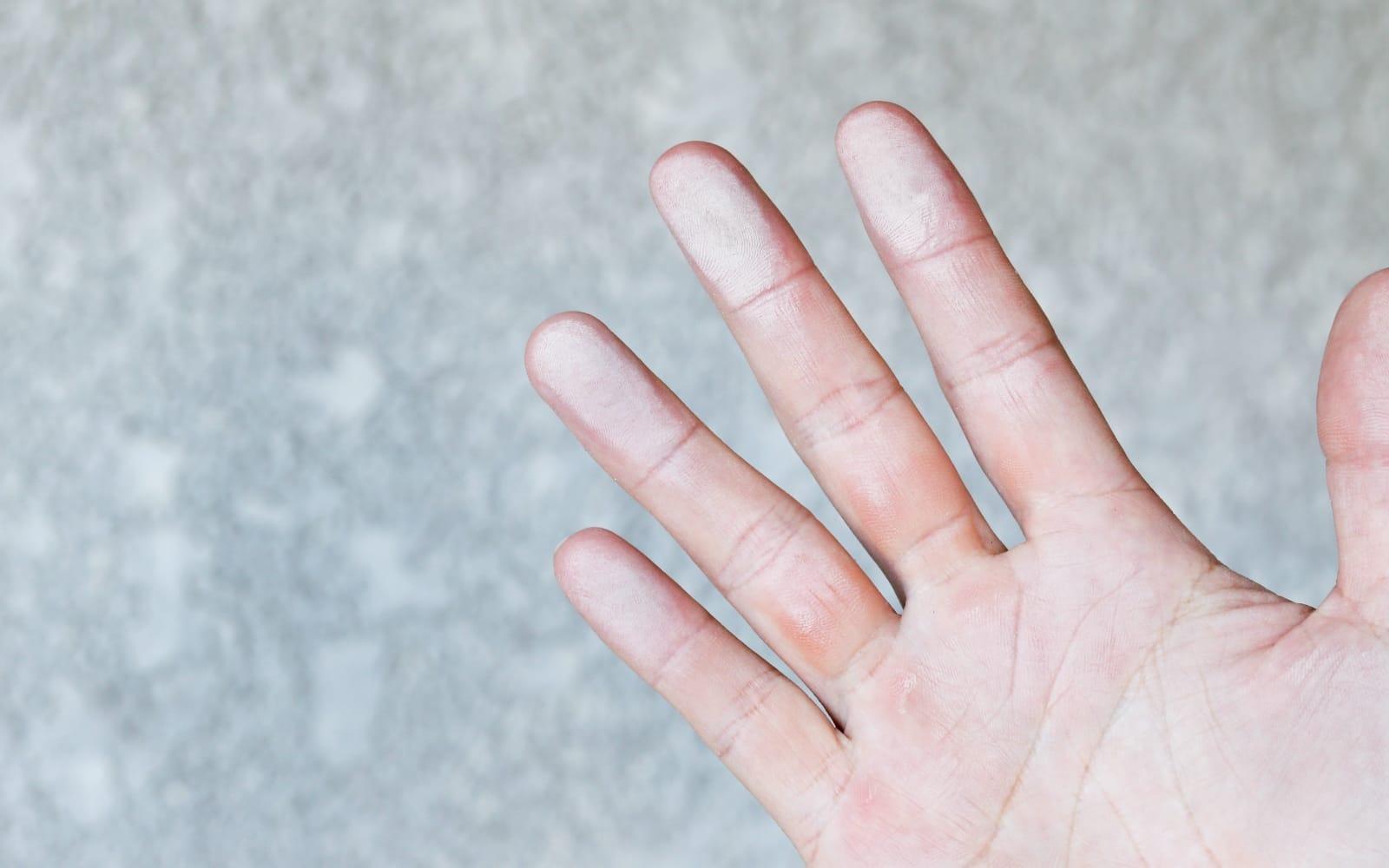 外壁を触った指先にに白い粉が付着している写真